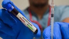 Fallecimiento de Trabajadora en Laboratorio Ruso de Investigación de Peste Genera Interrogantes